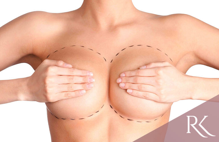 mamoplastia redutora