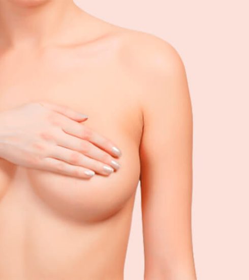 Mastopexia: Muitas mulheres, particularmente após amamentação ou emagrecimento, percebem seus seios flácidos e perdendo a forma, o volume e a firmeza. Saiba mais!